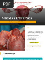 Miomas Uterinos