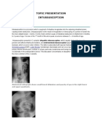 Presentation - Intussusception