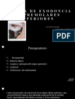 Técnica de Exodoncia de Premolares Superiores