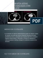 Tomografía Axial Computarizada Con Contraste