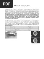 Intoxicación Crónica Por Plomo Caso Clinico