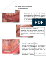 Tema 2 Lesiones Reactivas No Infecciosas