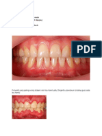 Materi Flipchart Gingivitis Gravidarum