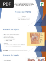 Hepatocarcinoma