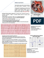 Ecg Bloqueios e Hemibloqueios