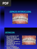 Espacio Interoclusal