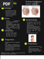 Infografia Parotiditis