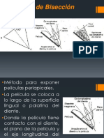 Técnica de Bisectriz