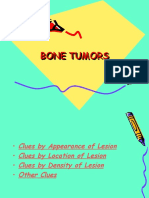 Bone Tumors