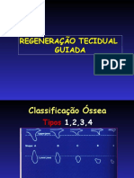 Regeneração Tecidual Guiada