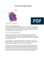 Facts About Ventricular Septal Defect