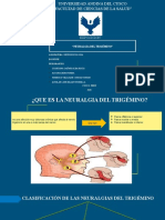 Neuralgia Del Trigemino