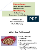 Gall Stones