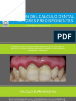 Calculo Dental y Otros Factores