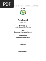 Electrocardiograma Normal