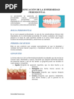 Clasificación de La Enfermedad Periodontal