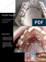 Rejilla Lingual