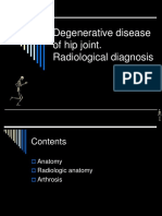 7.17 Degenerative Disease of Hip Joint. Radiological Diagnosis