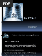 RX Torax