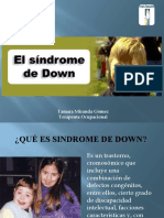 Sindrome de Down