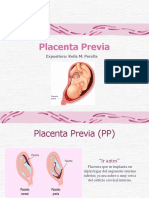 Placenta Previa