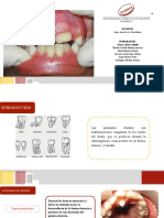 Alteraciones de La Erupción Dentaria: Odontopediatría II