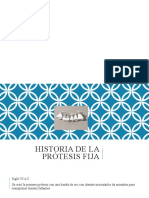 Historia de Protesis Fija