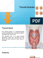 Thyroid Nodules