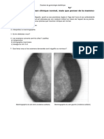 Examen Clinique Normal, Mais Que Penser de La Mammographie