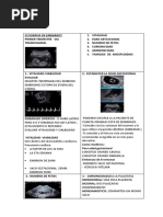 Ecografia Embarazo