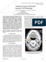 An Uncommon Cancer of Parotid Squamous Cell Histology