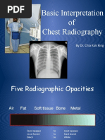 Basic Interpretation of CXR