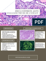 La Glomérulonéphrite Aigüe Post-Infectieuse de L'enfant