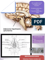 Adenoma Hipofisiario Consultorio 10