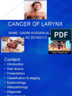 Cancer of Larynx