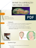 Síndrome Da Aspiração Meconial (Sam)