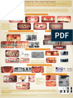 Orthodontie Pré Prothétique Copie