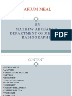 Barium Meal: BY Mathew Abubakar Department of Medical Radiography