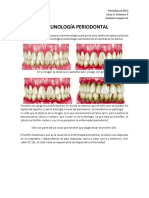 CLASE 4 - INMUNOLOGÍA PERIODONTAl