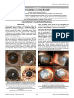 Corneal Laceration Repair!: Photo Essay