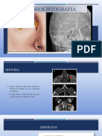 DACRIOCISTOGRAFIA