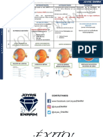 Ametropías (Miopía, Himermetropía, Astigmatismo, Presbicia)