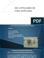 Enfilado o Articulado de Dientes Artificiales