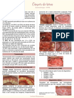 Câncer de Boca