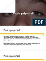 Ptosis Palpebral y Chalazion