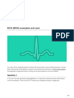 Ecg Ospe Quiz