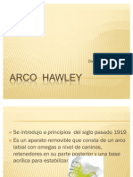 Aparato de Hawley