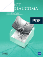 OCT and Glaucoma