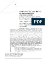 Utilidad Clínica de La Fusión SPECT/CT Con Marcadores Externos en Patología Oncológica