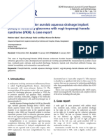 Panophthalmitis After Aurolab Aqueous Drainage Implant (AADI) in Refractory Glaucoma With Vogt-Koyanagi-Harada Syndrome (VKH) : A Case Report